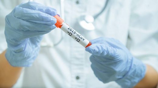 В Україні за минулу добу, 22 липня, виявили 763 нових випадки коронавірусної хвороби В Україні за минулу добу, 22 липня, виявили 763 нових випадки коронавірусної хвороби