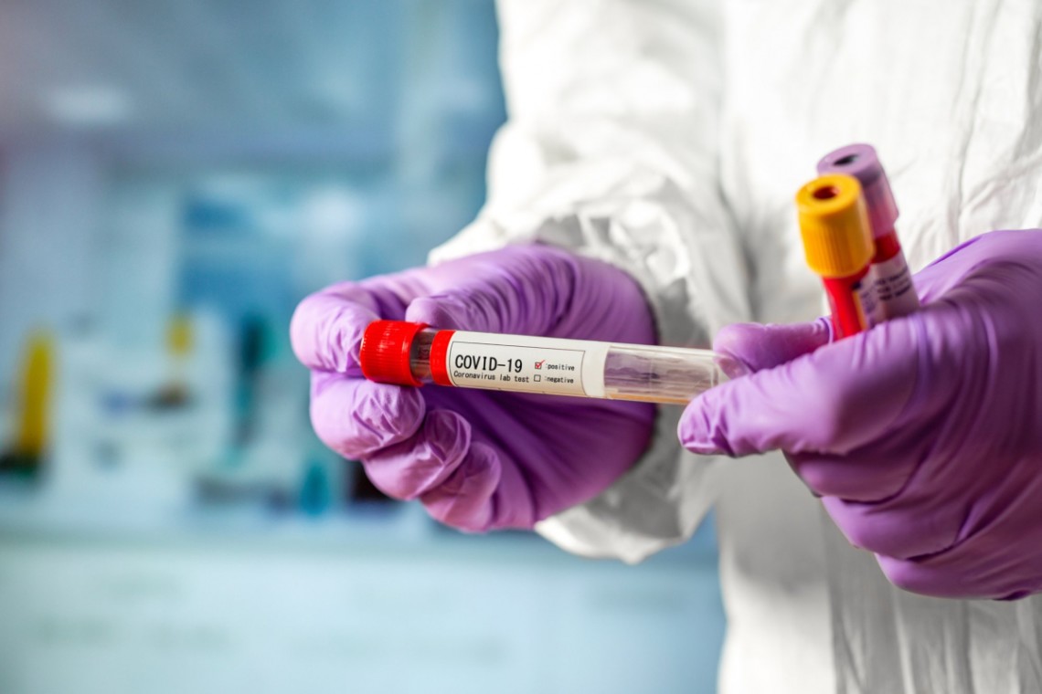 В Україні вже 2,278 млн випадків COVID-19, за добу - 1 581В Україні зафіксовано вже 2,278 млн випадків коронавірусної хвороби COVID-19 В Україні вже 2,278 млн випадків COVID-19, за добу - 1 581В Україні зафіксовано вже 2,278 млн випадків коронавірусної хвороби COVID-19