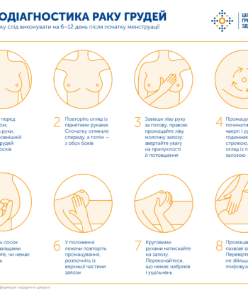 Самообстеження