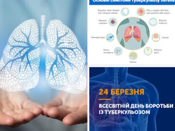 ТАК! МИ МОЖЕМО ПОДОЛАТИ ТУБЕРКУЛЬОЗ!